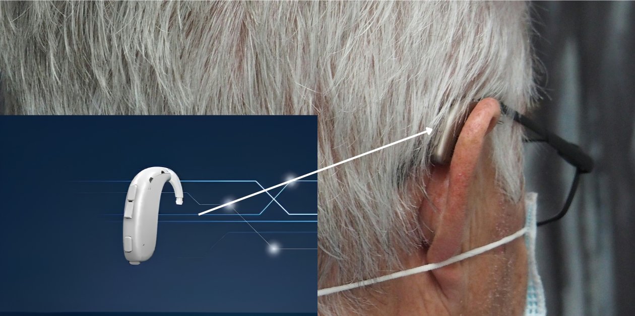 bte-hearing-aids-perfect-hearing-clinic