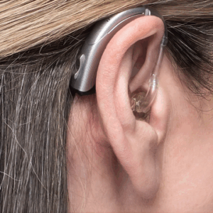 widex-bte-hearing-aids