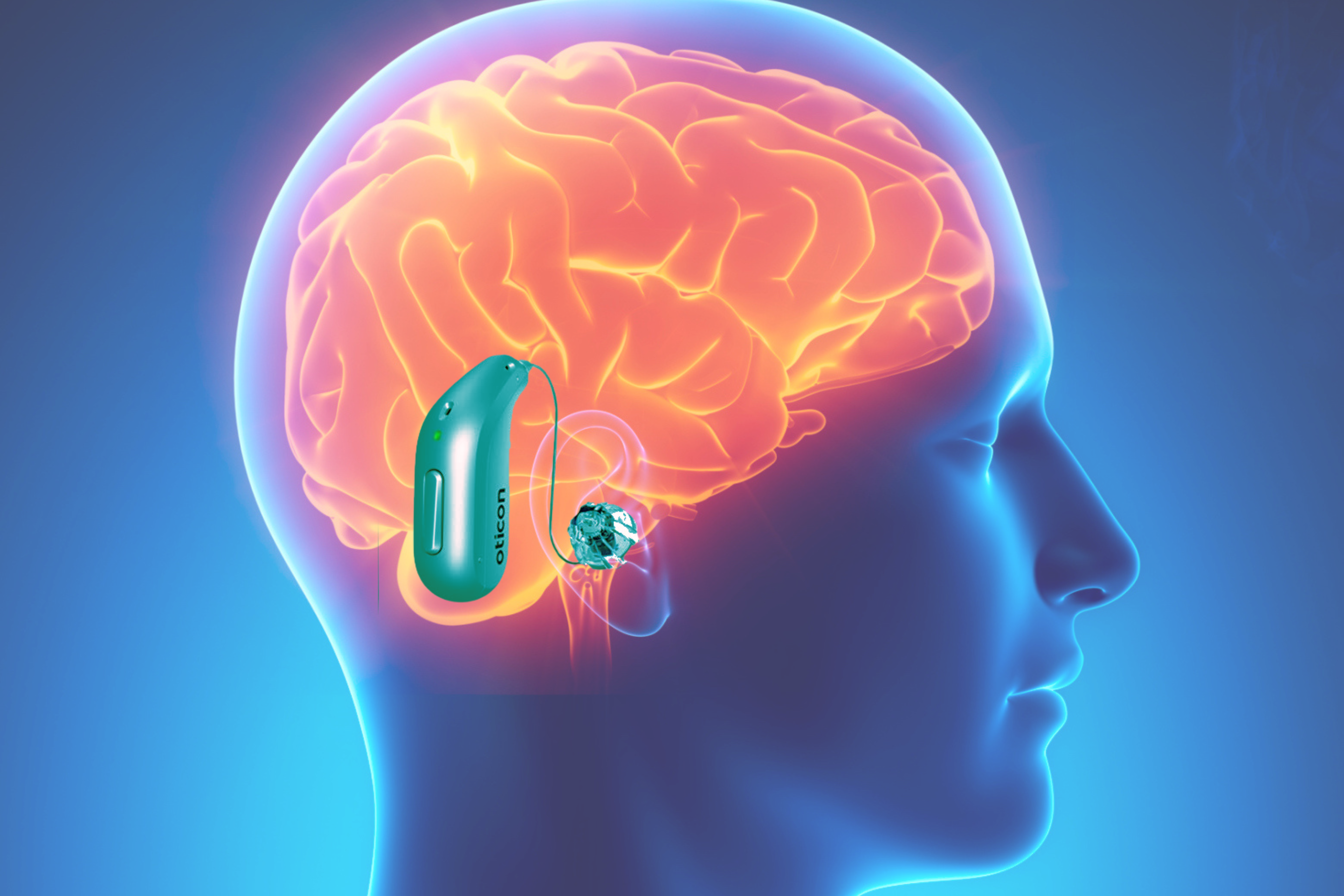 Hearing Aids and Brain Connection: Understanding the Profound Impact of Hearing on Brain Health